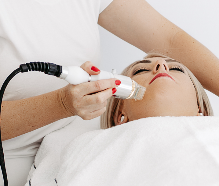 RF Microneedling Behandlung: Behandlerin führt das Handstück am Gesicht einer Kundin